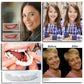 Snap-On Smile Teeth Cover – Natural Looking Cosmetic Veneers | Instant Perfect Smile Veneers – Upper & Lower Teeth Set