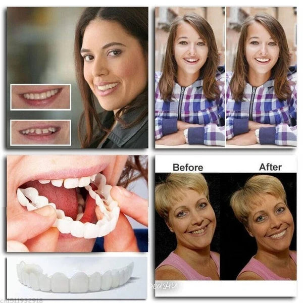 Snap-On Smile Teeth Cover – Natural Looking Cosmetic Veneers | Instant Perfect Smile Veneers – Upper & Lower Teeth Set
