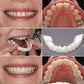 Snap-On Smile Teeth Cover – Natural Looking Cosmetic Veneers | Instant Perfect Smile Veneers – Upper & Lower Teeth Set