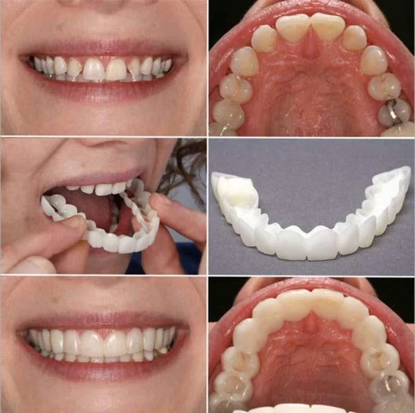 Snap-On Smile Teeth Cover – Natural Looking Cosmetic Veneers | Instant Perfect Smile Veneers – Upper & Lower Teeth Set