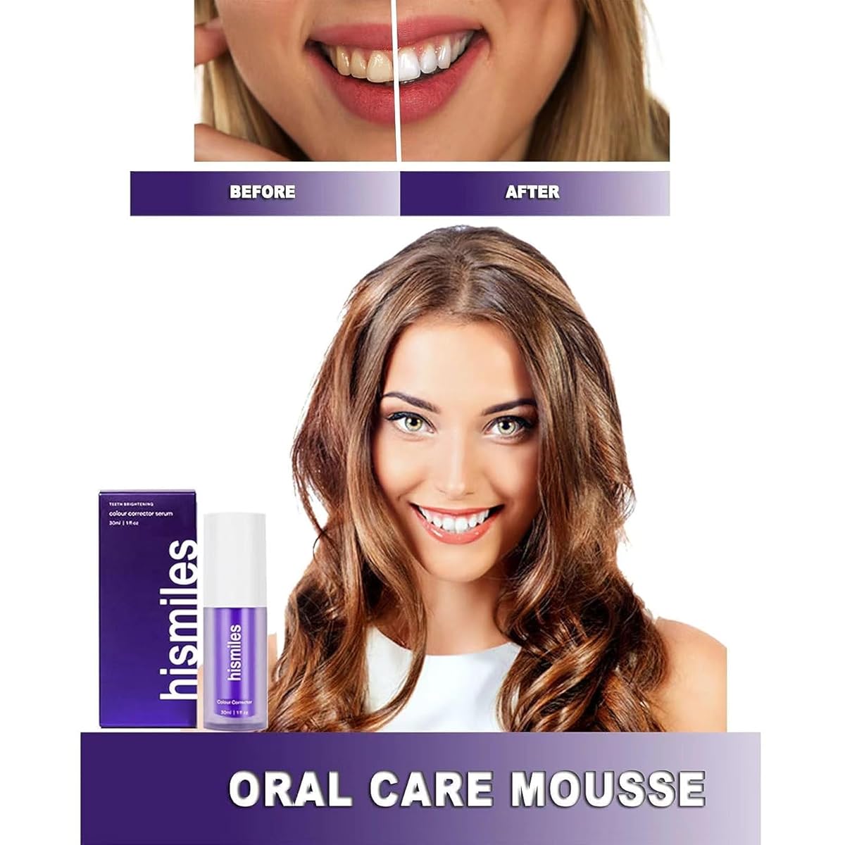 HiSmile V34 Purple Teeth Whitening Serum – Instant Stain Removal & Brighter Smile