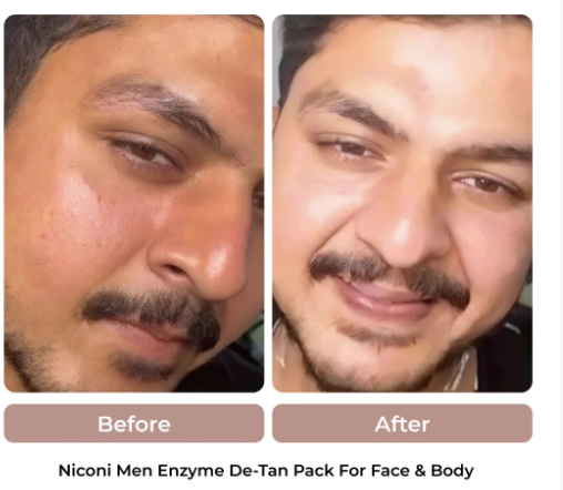 Niconi Men & Women Enzyme De-Tan Pack For Face & Body (300g)