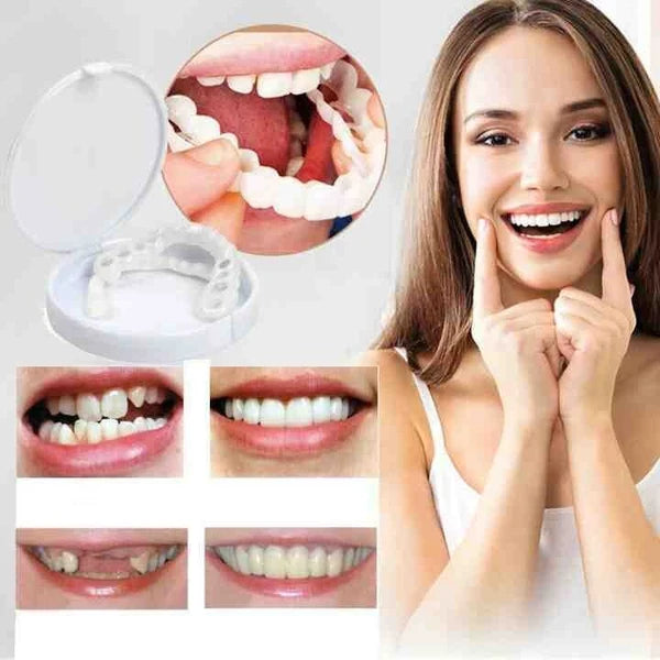 Snap-On Smile Teeth Cover – Natural Looking Cosmetic Veneers | Instant Perfect Smile Veneers – Upper & Lower Teeth Set
