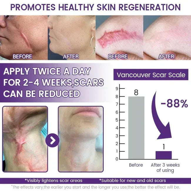 TiMilk - ReGen Scar Stem Cell Repair Gel (Imported)